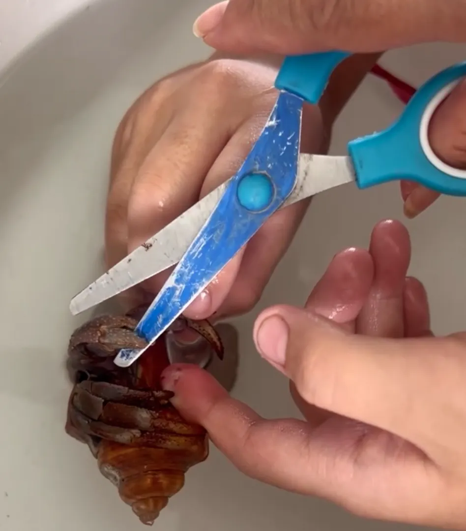 Cua ẩn sĩ dùng chân kẹp chặt ngón tay người chơi, gây sưng tấy và tổn thương da